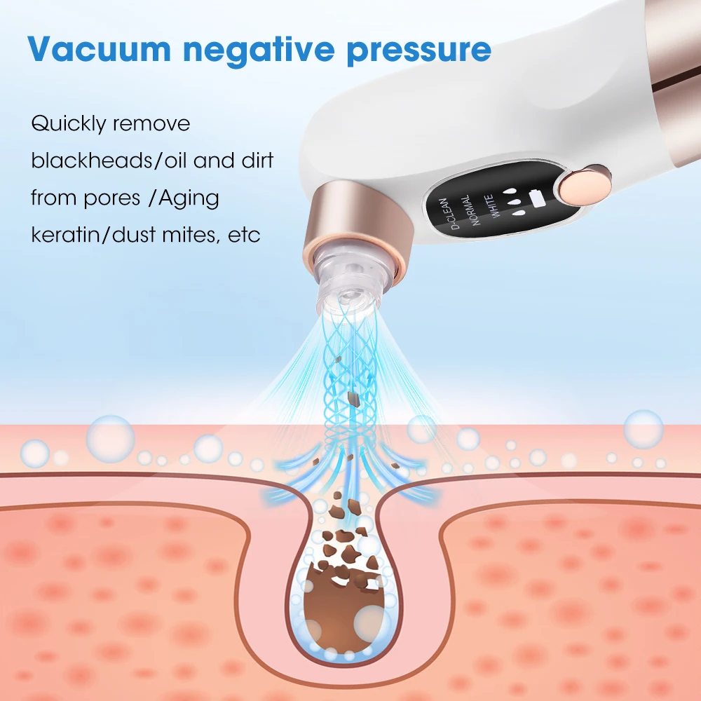 Electric Blackhead Remover Beauty Facial Cleaner Black Point Vacuum Suction Black Head Dots Remover Extractor Skin Care Tools