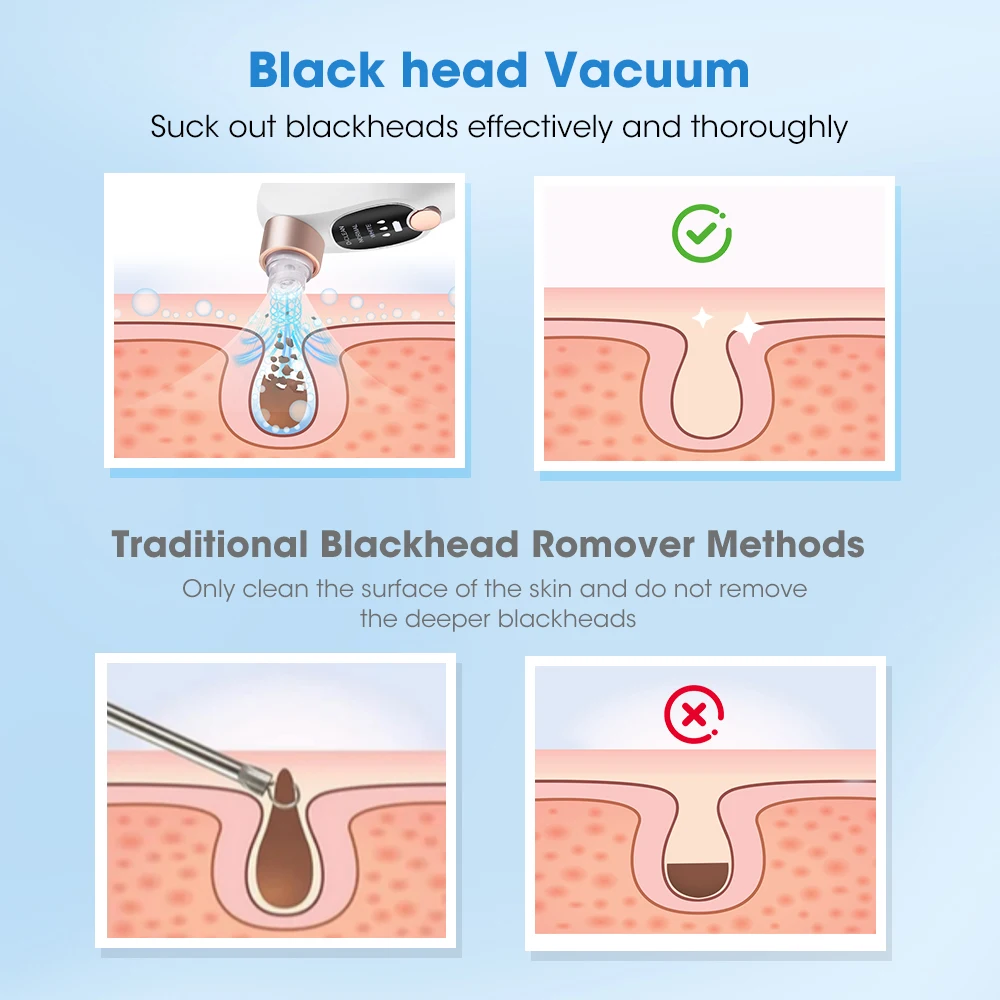 Electric Blackhead Remover Beauty Facial Cleaner Black Point Vacuum Suction Black Head Dots Remover Extractor Skin Care Tools